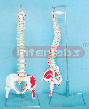 GIANT FLEXIBLE DIDACTICALLY PAINTED VERTEBRAE WITH PELVIS, OCCIPITAL BONE, VERTEBRAE ARTERY AND DORSAL HERNIATED DISC BETWEEN 3RD AND 4TH LUMBAR VERTEBRAE & LUXURY HANGING STAND